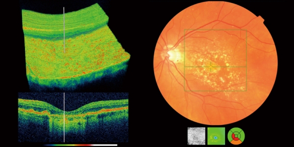 what-is-an-oct-scan-north-opticians-eyewear