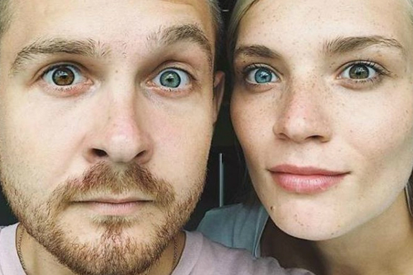 Siblings with heterochromia - two different coloured eyes.
